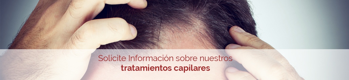 alopecia-hombre-call-action