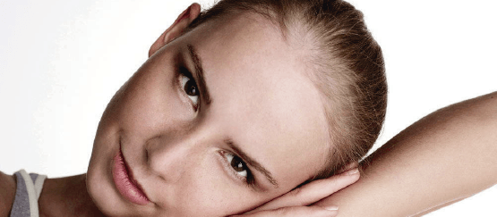 tratamientos-alopecia-androgenica-femenina-zaragoza